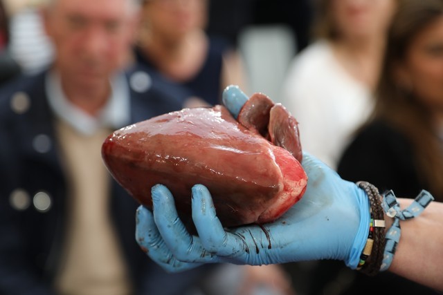 Ronqueo Atun Restaurante la Prensa Santander